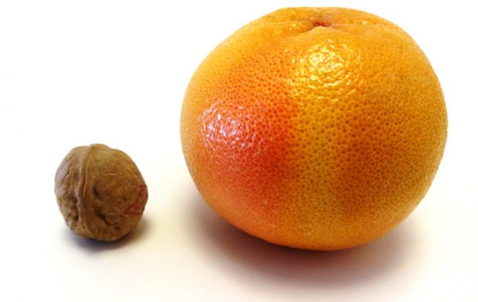 Is Your Prostate A “Walnut” or An “Orange?”
